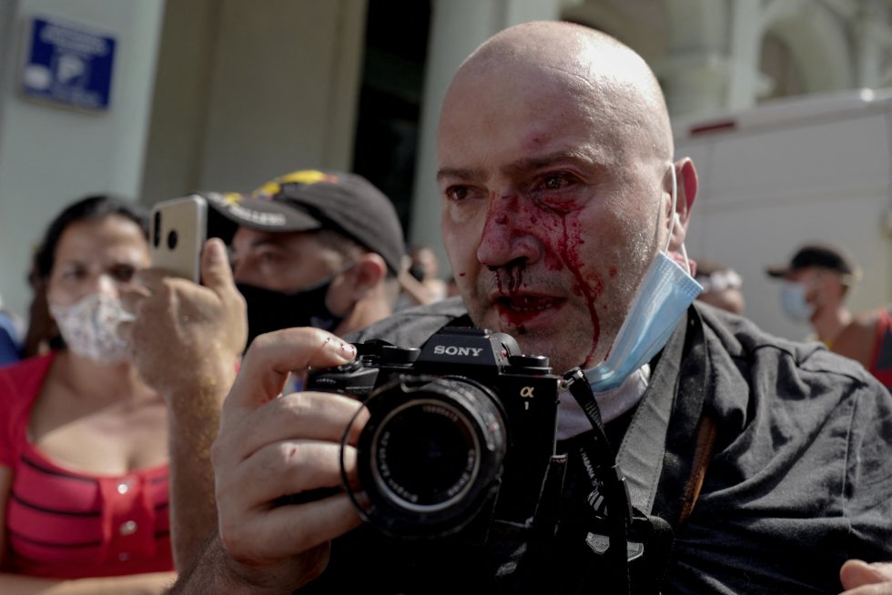 El fotógrafo español de AP Ramón Espinosa resultó herido durante las protestas contra el presidente cubano Miguel Diaz-Canel en La Habana. El fotógrafo español de AP Ramón Espinosa resultó herido durante las protestas contra el presidente cubano Miguel Diaz-Canel en La Habana.