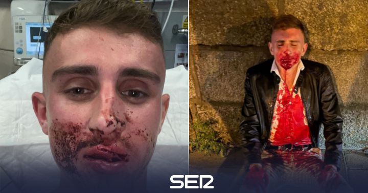 El taekwondista Jack Woolley tuvo que ser operado tras ser brutalmente agredido - Vimarsana News