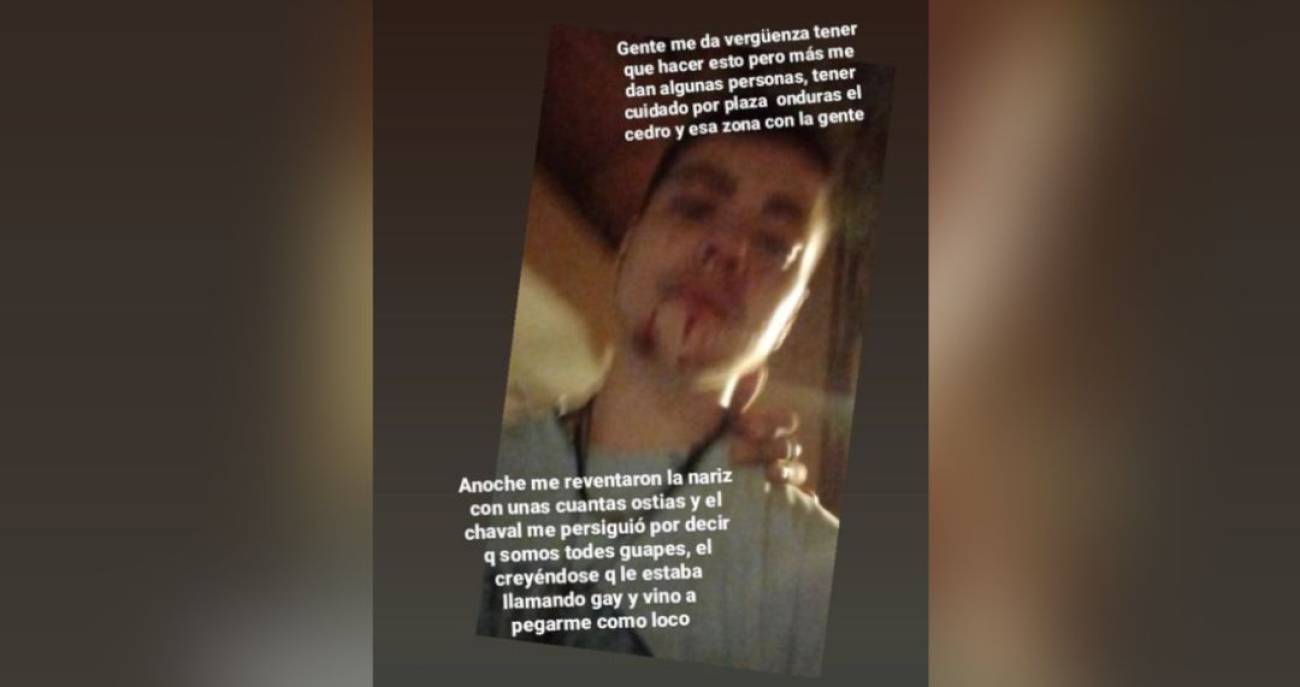 El joven ha denunciado ante la Policía y en sus redes sociales la agresión. Autor: Joven agredido en Valencia, 08/09/2021. Fuente: Instagram