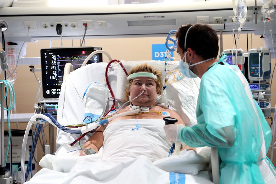 Paciente tratada con soporte ECMO en la UCI del Hospital de la Vall d'Hebron