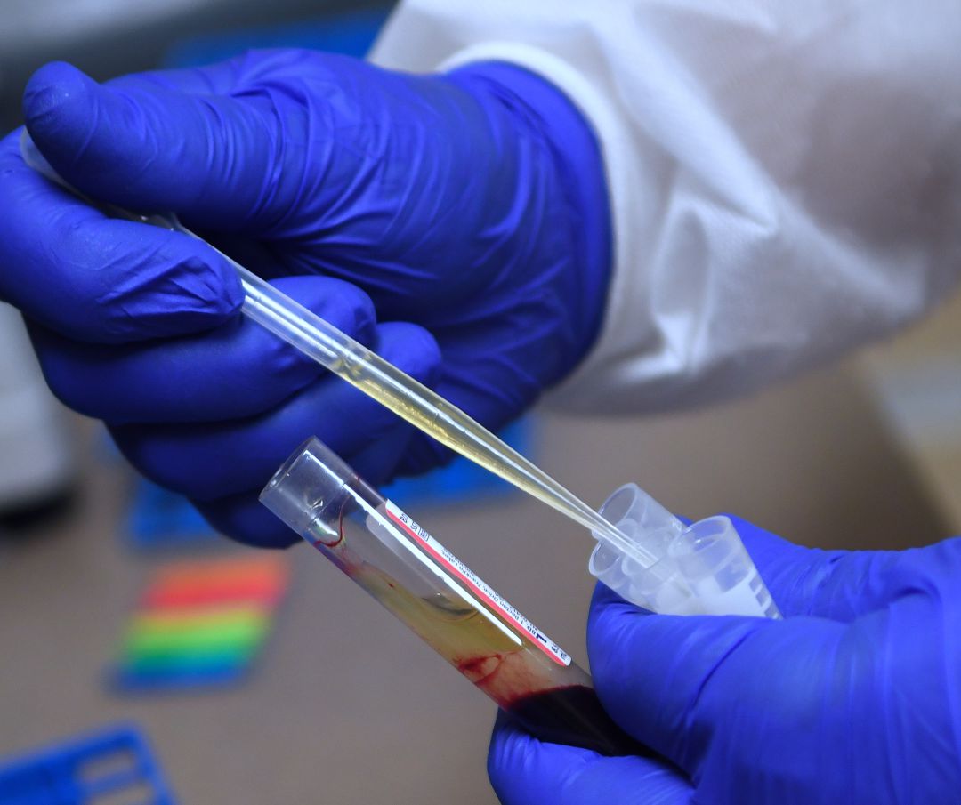 Una muestra de sangre es preparada para un análisis para la vacuna de COVID-19 por el laboratorio Moderna.